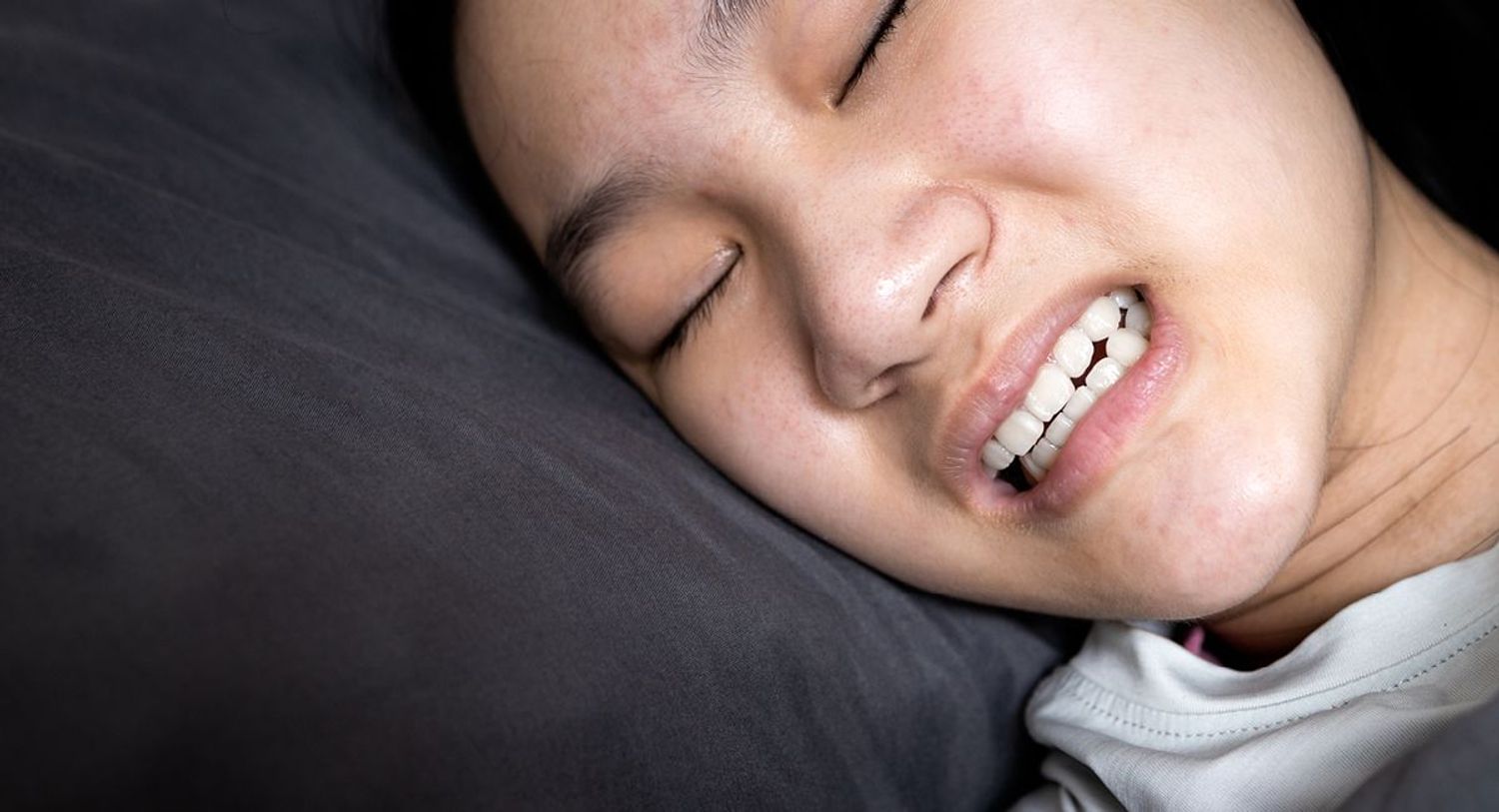 Preventing-and-treating-bruxism
