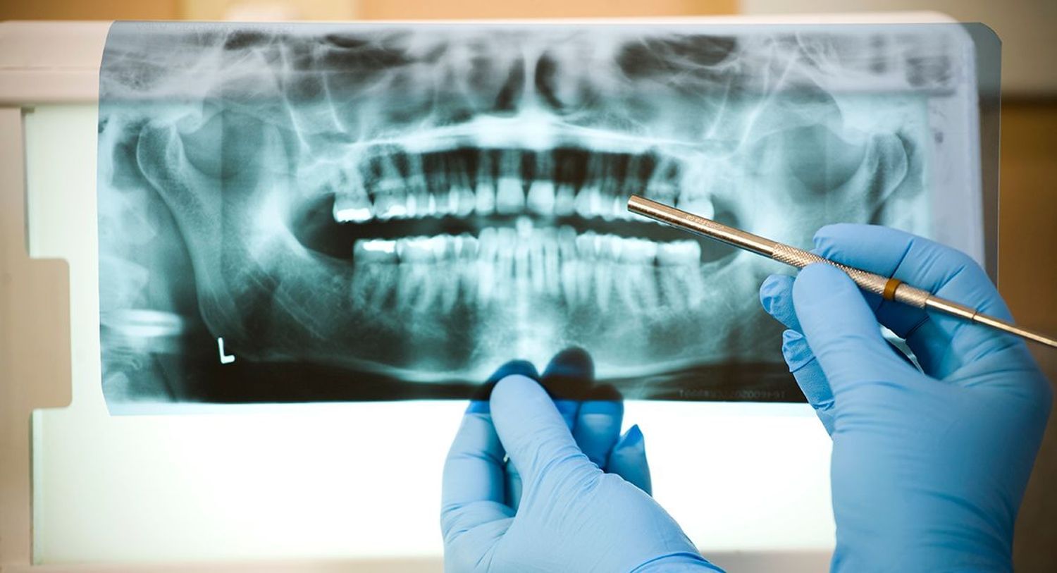 X-ray board being examined by a dentist