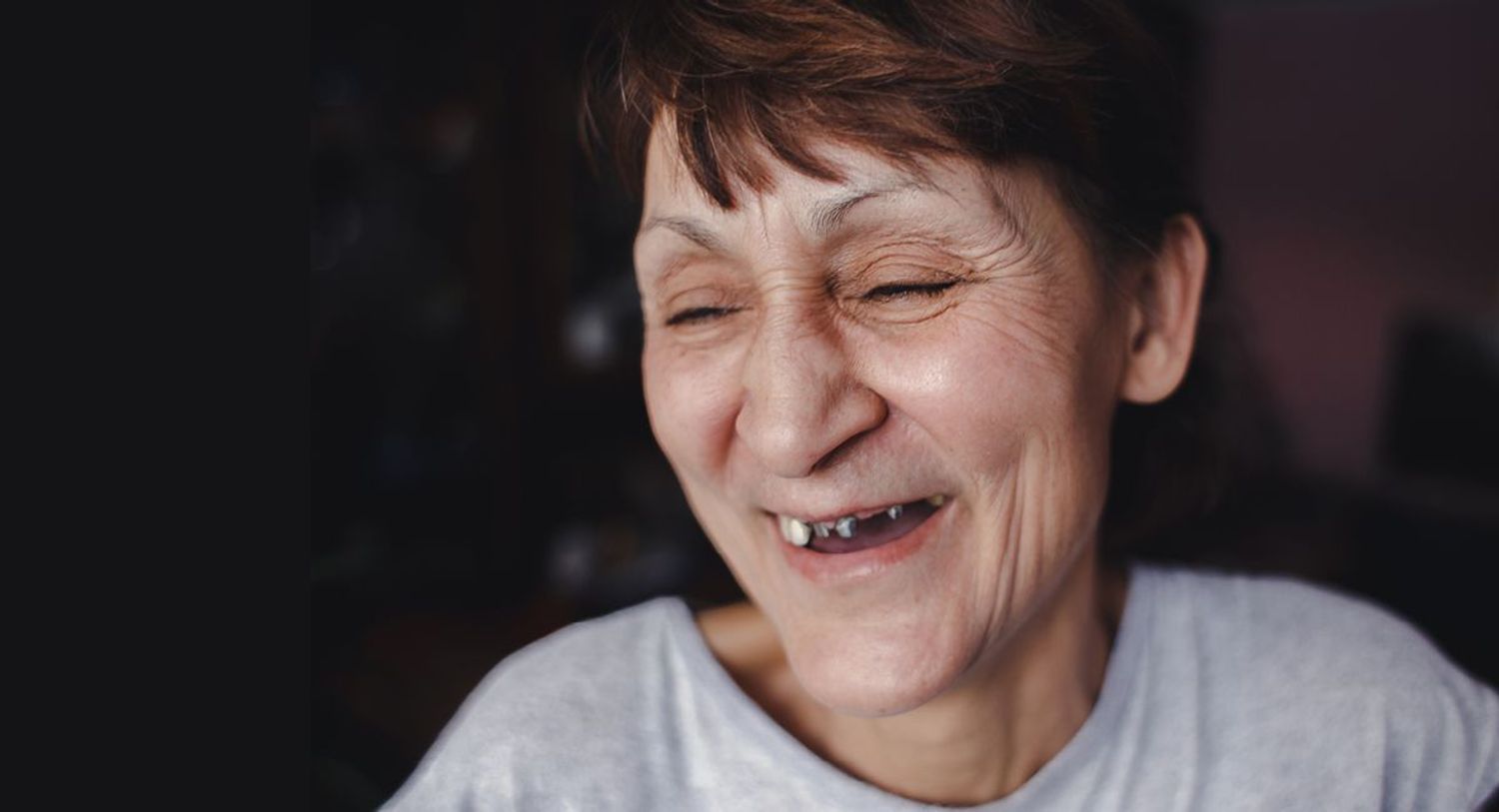 Woman smiling without full set of teeth