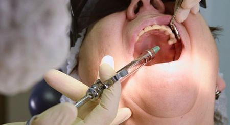 Someone's mouth being injected with local anaesthesia
