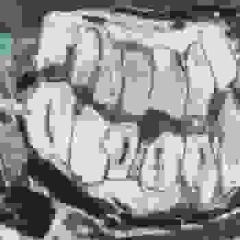 Placeholder for JC 0936