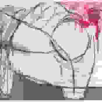 Placeholder for JC 0944