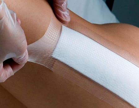 OpSite Post-op, filmforbinding med Melolin kompres, steril, 5 cm x 6,5 cm