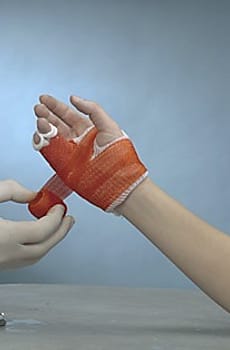 Soft Cast, syntetisk gipsbandage, rød, 5 cm x 3,6 m