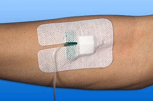 Rudaven plus, IV bandage med kompres, non woven, steril, 6 cm x 8 cm