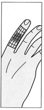 Nobanetz, elastisk netfiksering, finger nr. 0,, 25 m