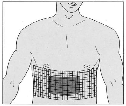 Nobanetz, elastisk netfiksering, bryst(junior) nr. 7, 25 m