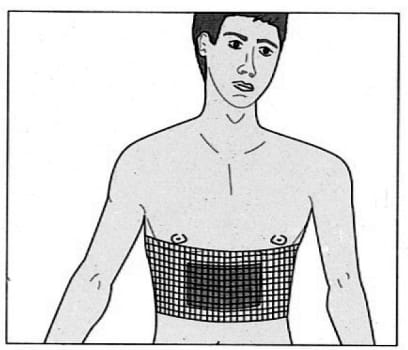 Nobanetz, elastisk netfiksering, bryst(voksen) nr. 8