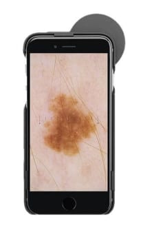 HEINE iC1, Digitalt Dermatoskop til iphone 7/8