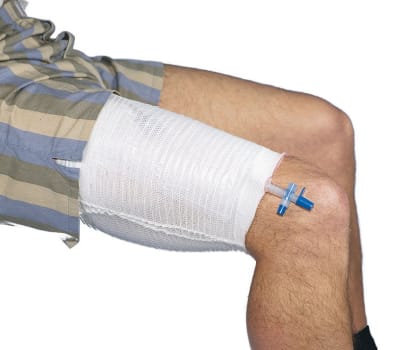 CareFix, Urinposefiksering, blå, 45-65 cm, medium