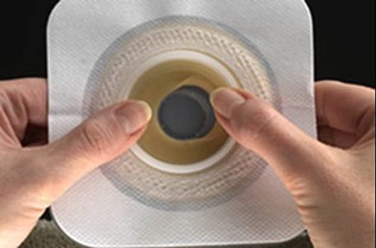 Combihesive II Plus, Stomahesive Moldable plade, 22-33mm, 45 mm ring