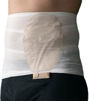 StomaSafe, stomifiksering, omkreds 115-145cm, hvid, x-large