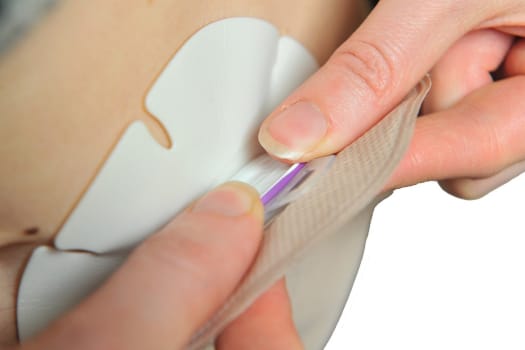 eakin dot, 2-dels colostomipose, Maxi, vindue, beige, 80 mm ring