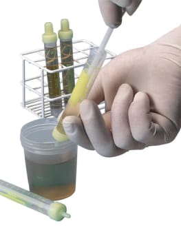 Urintest, Urin Monovette, Gul, u/ stabilisator (borsyre), 10 ml