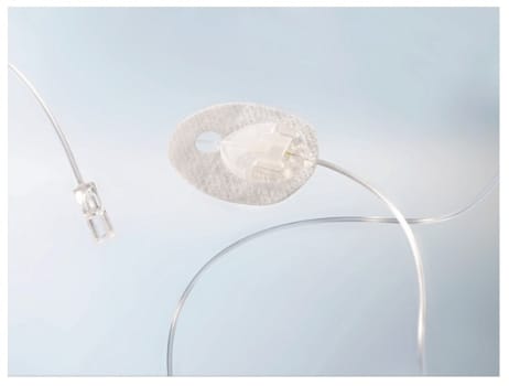 Neria Soft, Infusionssæt 27G 30 cm slange, 13 mm