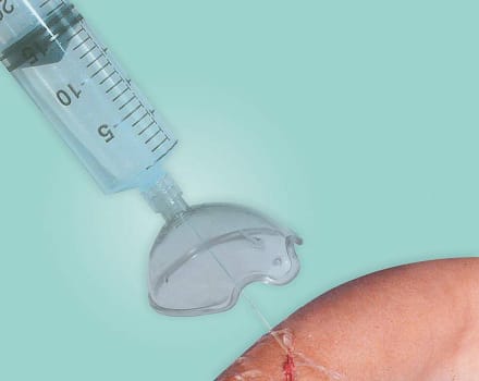 Combiguard II, sårskyllekapsel, steril