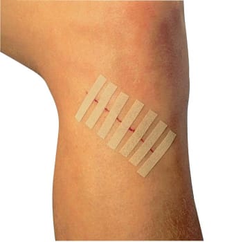 Steri-Strip, suturtape beige, elastisk, steril, 6 mm x 75 mm