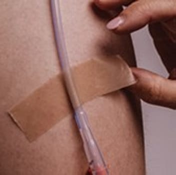 Spycra Sil-Tape, Fikseringstape med silikoneklæb, på rulle, beige, 5,0 cm x 150 cm