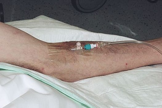 Rudaven transparent, IV bandage, PU film, steril, 6 cm x 8 cm