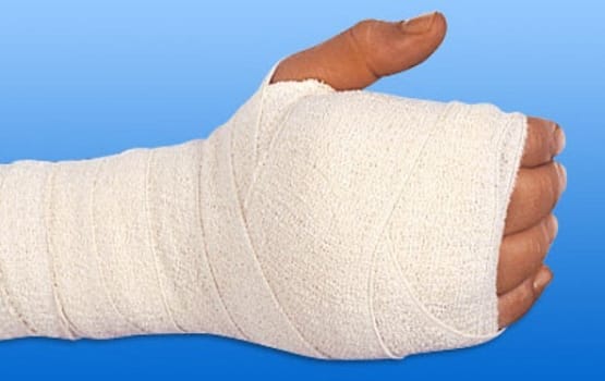 NOBACREPP, crepebind, enkeltvis pakket, 6 cm x 4 m