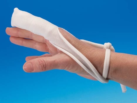 Nobalinge, fingerforbinding, elastisk