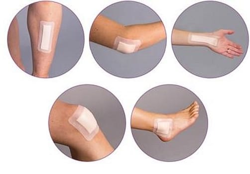 FoamLite ConvaTec, tynd skumbandage m/silikoneklæb og border, steril, 10 cm x 20 cm