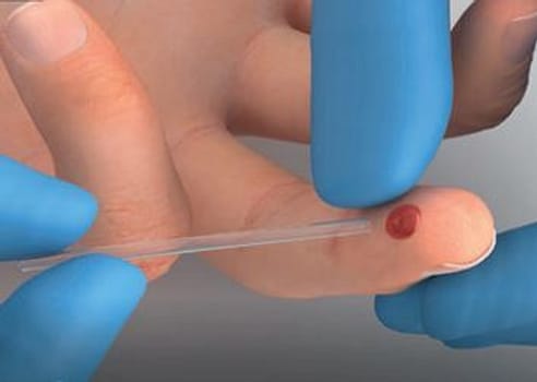 Labpad Evolution, kapillærrør til K SMART, CRP test, 10 ul