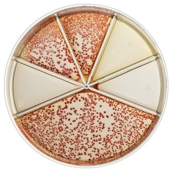 Flexicult, urinkit, agar plade, m 5 antibiotika, humant brug