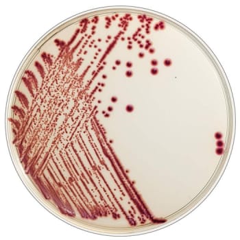 Flexicult, Chrom agar Flexicult ID