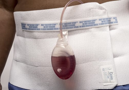 Dale, støttebælte 410, 75-114 cm