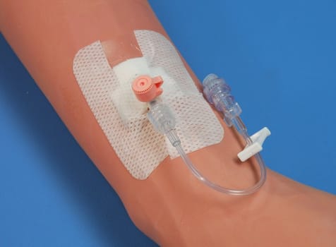 Q-Syte, injektionsmembran m.splitseptum, micro sl., steril, 15 cm