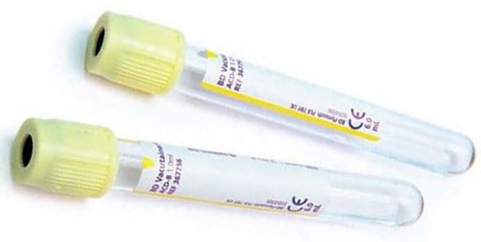 BD Vacutainer ACD-lasiputki liuos B