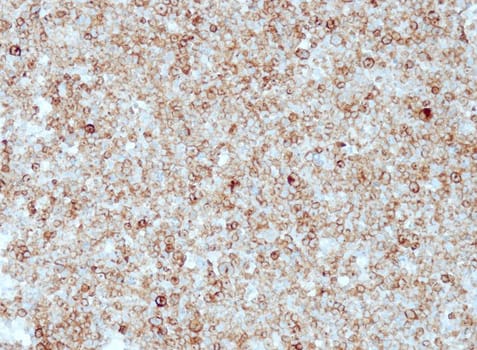 pan-TRK (QR008) Rb 0,1 ml konsentraatti