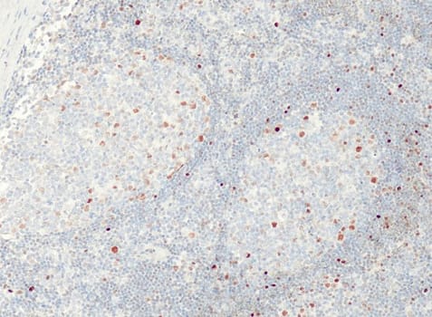c-Myc (QR061) Rb 0,5 ml konsentraatti