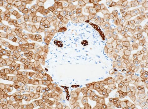 Cytokeratin pan (QR124) Rb 0,5 ml konsentraatti