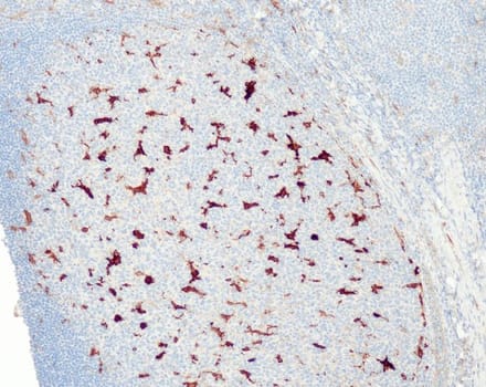 Glutamine synthetase (QR090) Rb 1,0 ml konsentraatti