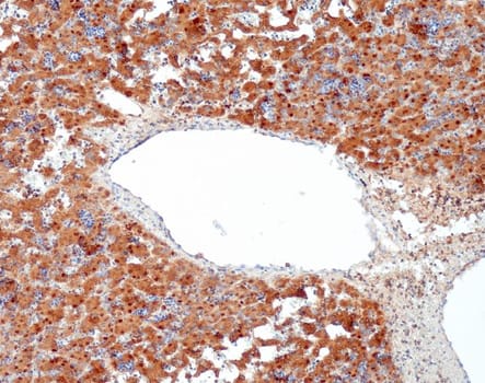Arginase-1 (QR083) Rb 0,5 ml konsentraatti