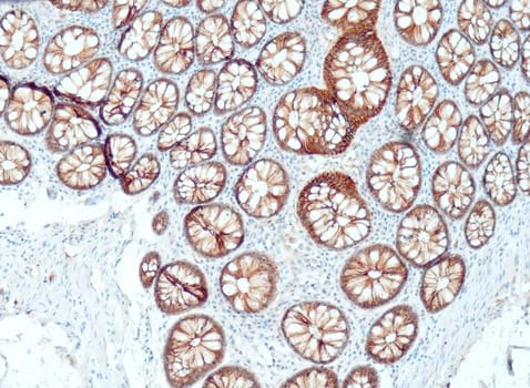 E-Cadherin (QR035) Rb 7 ml RTU liuos