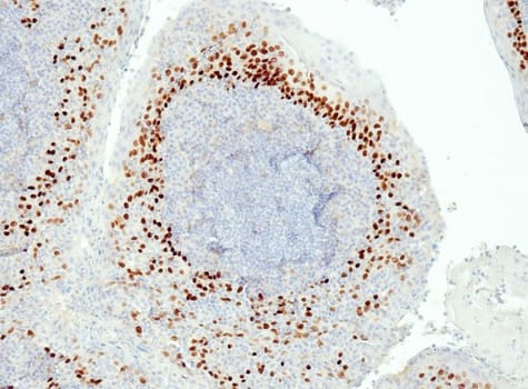 p63 (QR007) Rb 1,0 ml konsentraatti
