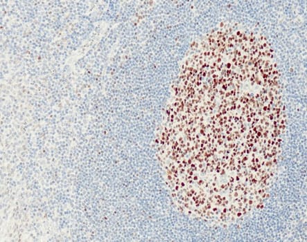 Bcl6 (QR047) Rb 3 ml RTU liuos