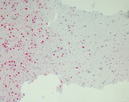 IDH1 R132H (QM002) Ms 1,0 ml konsentraatti