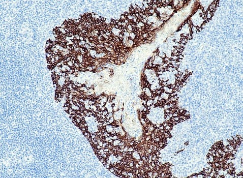 Cytokeratin 5 (QR027) Rb 3 ml RTU liuos