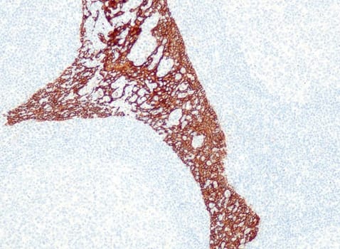 Cytokeratin 5/6 (QR027 & QR028) Rb 3 ml RTU liuos