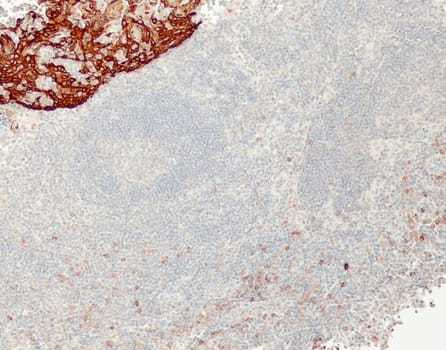 Cytokeratin 5/14 (QR027 & QR057) Rb 0,5 ml konsentraatti