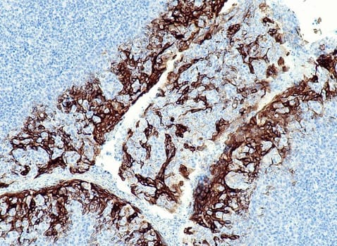 Cytokeratin 6 (QR028) Rb 0,5 ml konsentraatti