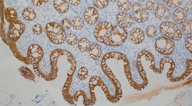 Cytokeratin 20 (Ks20.8) Ms 7 ml RTU liuos