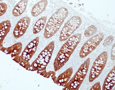 Cytokeratin 19 (QR125) Rb 1,0 ml konsentraatti