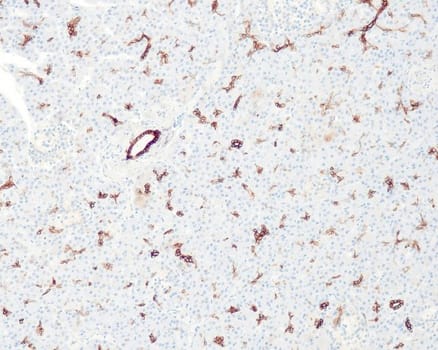 Cytokeratin 7 (QR049) Rb 0,5 ml konsentraatti