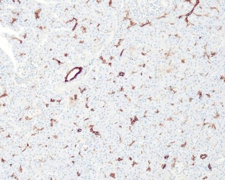 Cytokeratin 7 (QR049) Rb 1,0 ml konsentraatti