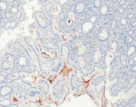Helicobacter pylori (QR091) Rb 0,5 ml konsentraatti